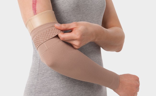 bstaendig-gesundheit-kompression-narbenterapie-juzo-scar-comfort