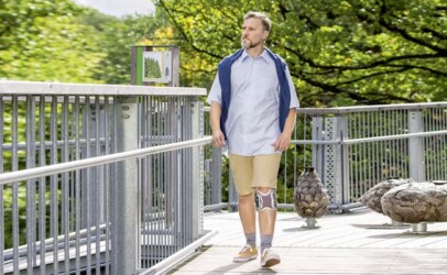 Mann auf Terrasse mit Natur im Hintergrund nutzt Funktionelle Elektrostimulation (FES) von ottobock Bioness für Rehabilitation.
